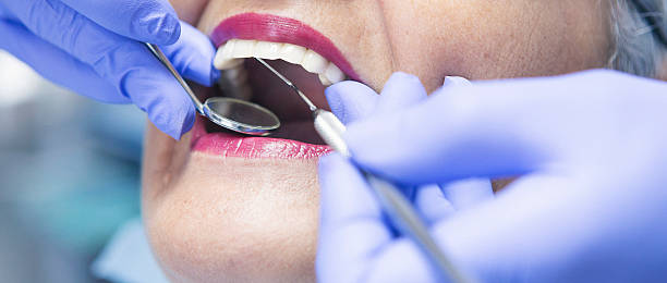 Best Emergency Tooth Extraction in Terra Bella, CA